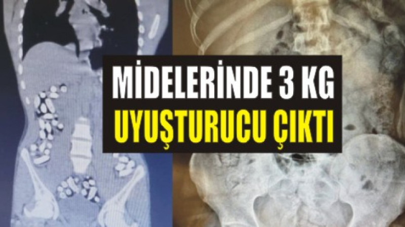 Midelerinden 3 kilo uyuşturucu çıktı!